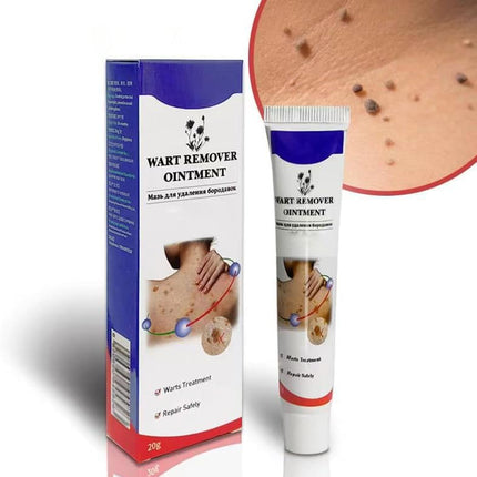 Warts Remover