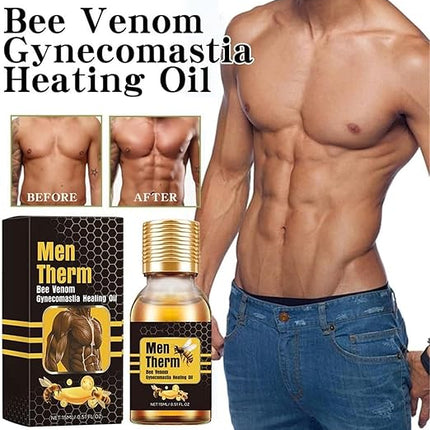 Men Therm - Bee Venom Gynecomastia Heating Oil (Original)