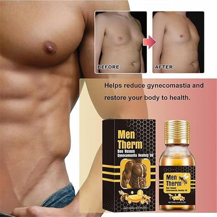Men Therm - Bee Venom Gynecomastia Heating Oil (Original)
