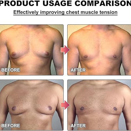 Men Therm - Bee Venom Gynecomastia Heating Oil (Original)